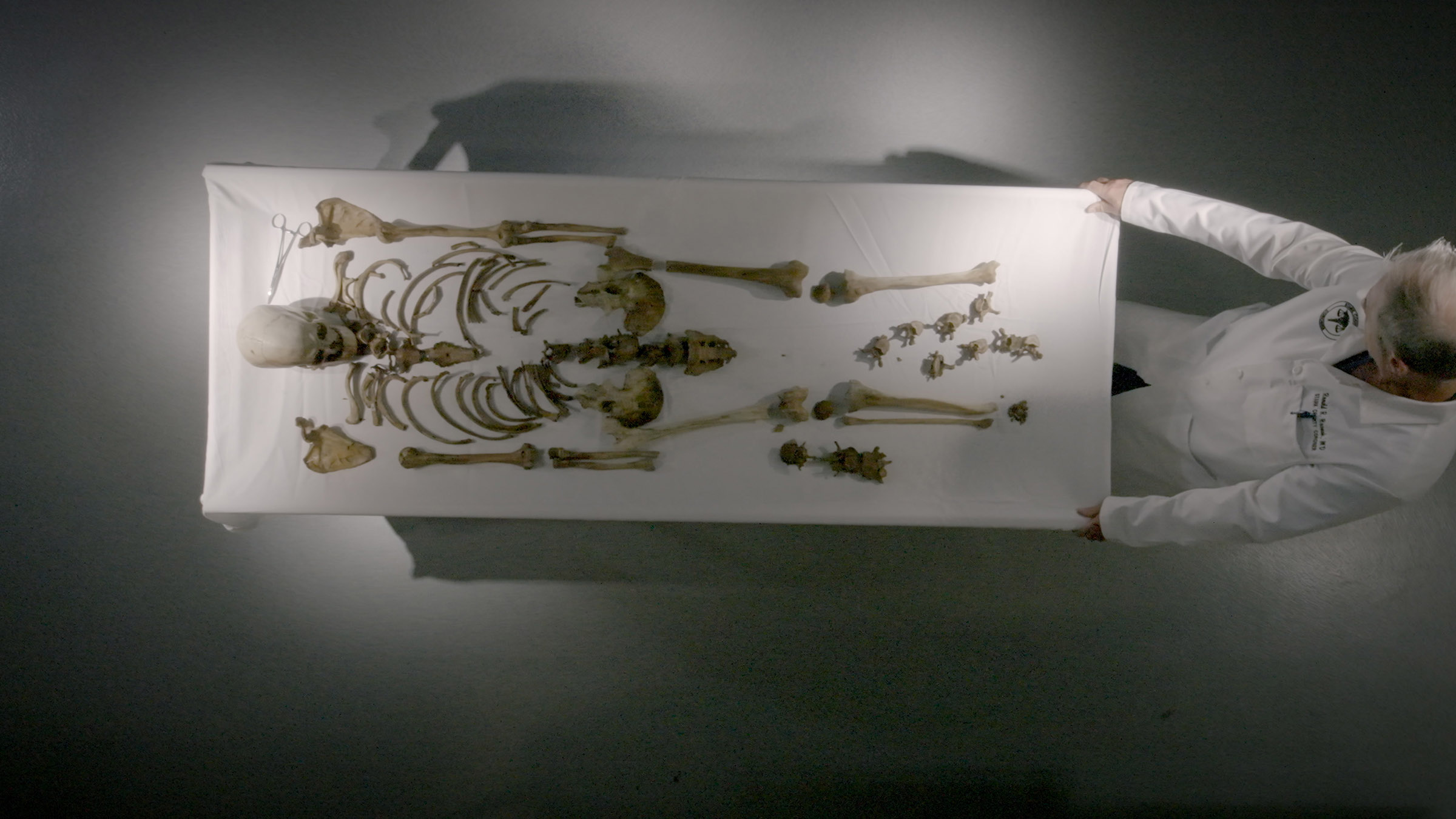 The body of a John Doe found with a fractured skull is laid out by the coroner. Image from... [Photo of the day - August 2025]